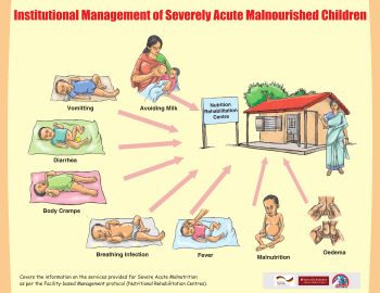 Institutional Management of Severely Acute Malnourished Children